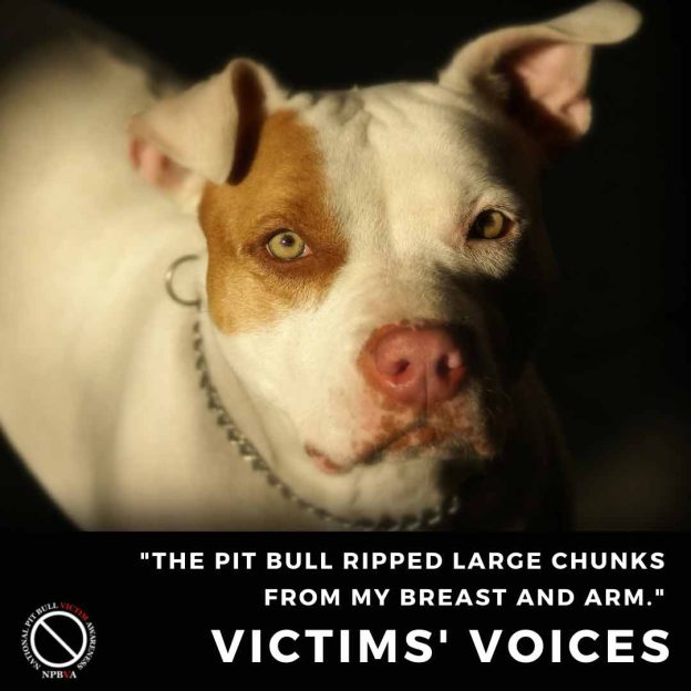 As a 13-year-old child I was mauled by a pit bull