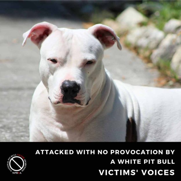 White pit bull attacks with no provocation