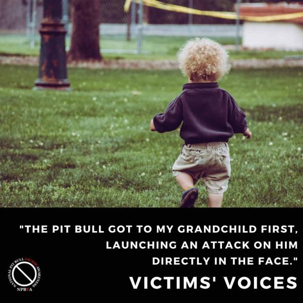 Pit bull mauls toddler in unprovoked attack