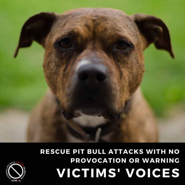 Rescue pit bull attacks with no provocation or warning